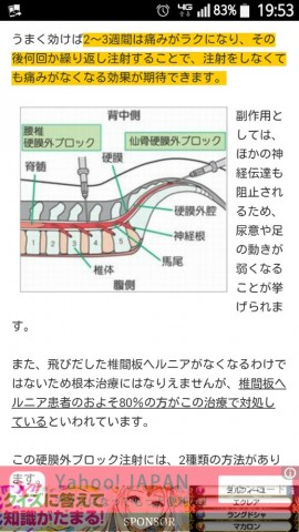 c8t834sji7zt2a9t7vd8_518_920-f31587e8.jpg